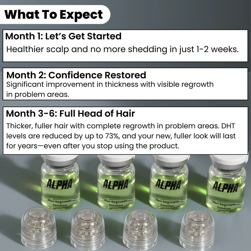 AlphaInfuse™ Starter Kit | 1-Month Hair Regrowth & Infusion System for Fuller Hair